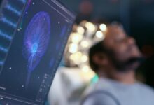 Fatherhood changes men’s brains, according to before-and-after MRI scans