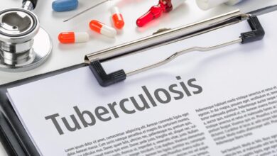India needs innovative strategies to eliminate TB