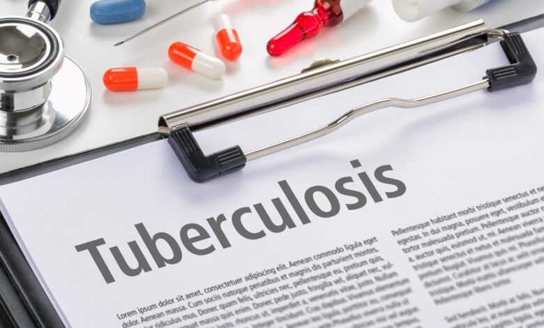 India needs innovative strategies to eliminate TB